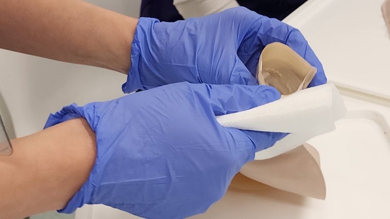 emptying colostomy bag